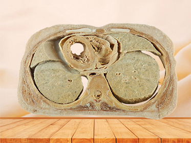 Horizontal slices of com plete female body plastinated specimen