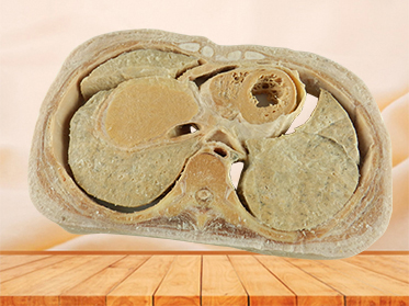 Horizontal slices of com plete female body plastination