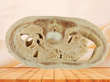 Horizontal slices of com plete female body specimen