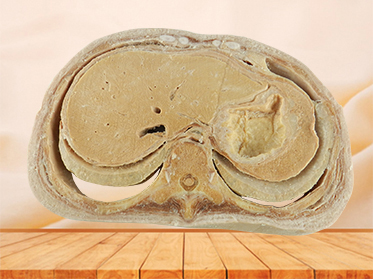 Horizontal slices of com plete female body specimen for sale