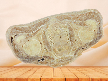 Horizontal slices of complete male body