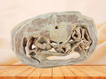 Horizontal slices of complete male body plastinated specimen