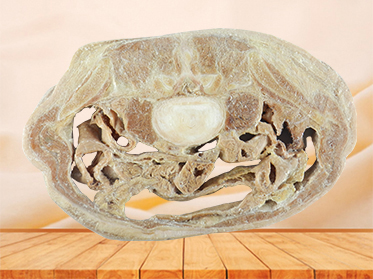 Horizontal slices of complete male body plastination