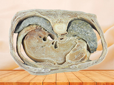 Horizontal slices of complete male body specimen