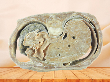 Horizontal slices of complete male body specimen for sale