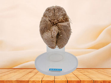 Human arteries of base of brain plastinated specimen