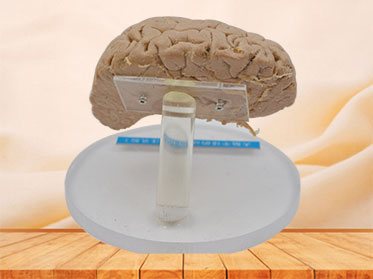 Human artery of cerebral hemisphere