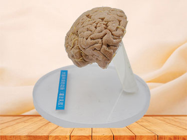 Human artery of cerebral hemisphere plastinated specimen