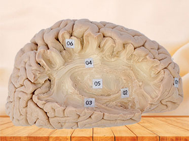 Human association fiber of cerebral hemisphere plastinated specimen