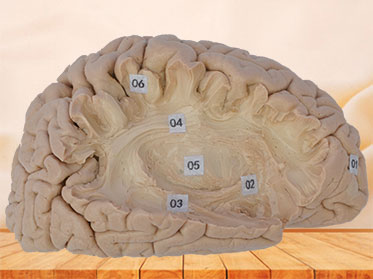 Human association fiber of cerebral hemisphere plastination
