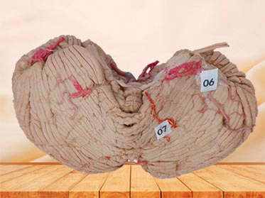 Human cerebellar artery plastinated specimen