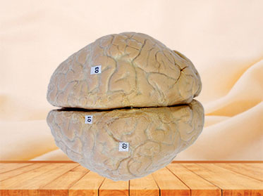 Human cerebral arachnoid mater plastinated specimen