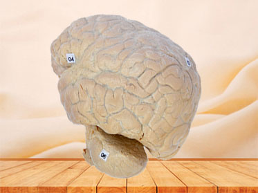 Human cerebral arachnoid mater plastination