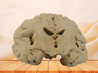 Human coronal section of brain