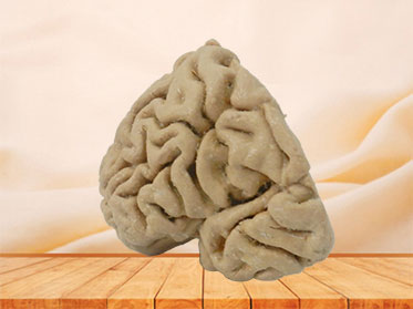 Human coronal section of brain plastinated specimen