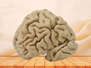 Human coronal section of brain plastination