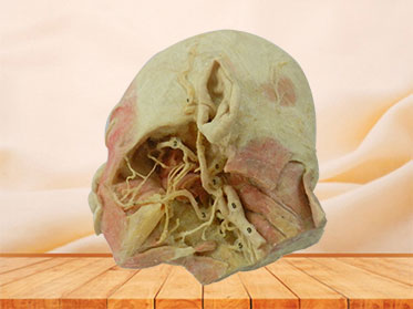 Human deep vascular nerve of head and face plastination