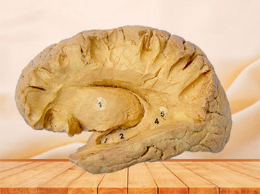 Human hippocampal formation plastinated specimen