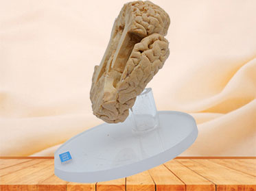 Human paracele plastination