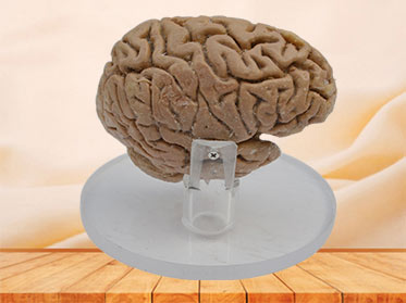 Human pituitary and pineal gland