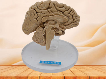 Human pituitary and pineal gland  plastinated specimen
