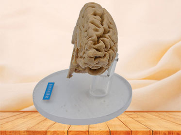 Human pituitary and pineal gland  plastination specimen