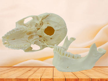 Human skull