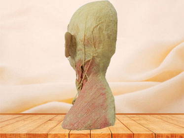 Human superficial vascular nerve of head and neck plastination