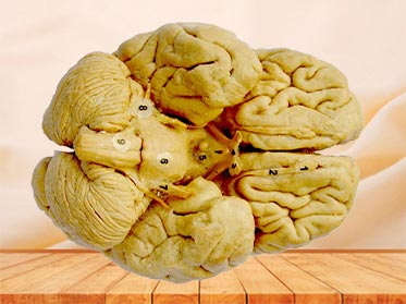 Human whole brain plastinated specimen