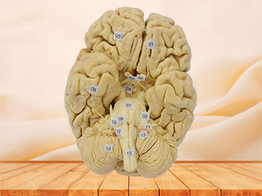 Human whole brain plastination specimen