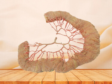 Ileum vascular arch