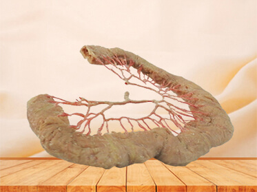 Jejunum vascular arch