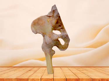 pelvis ligaments