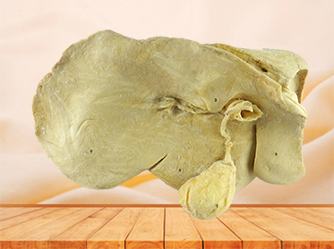 Liver of Cattle plastination