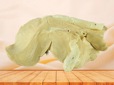 Liver of sheep medical specimen