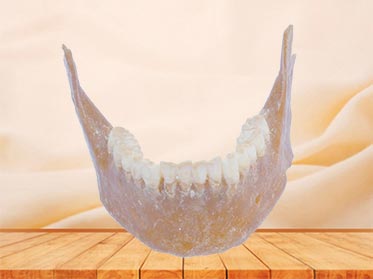 Mandible bone plastinated specimen