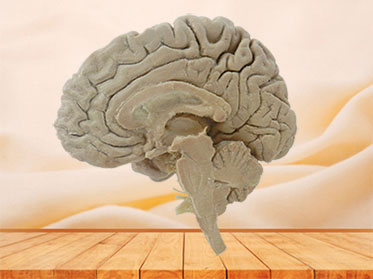 Median sagittal section of brain plastinated specimen