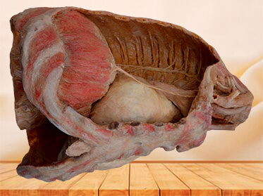 Mediastinal organs and diaphragm specimen