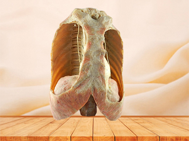 Mediastinal viscera with thorax specimen