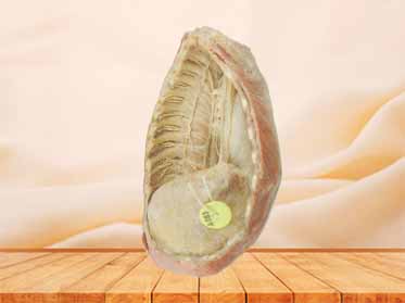 Mediastinum