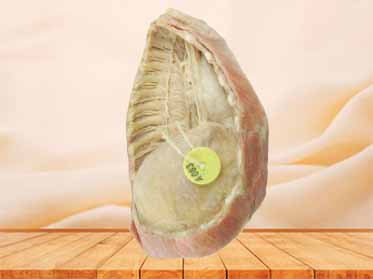 Mediastinum for sale