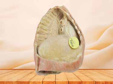 Mediastinum medical specimen