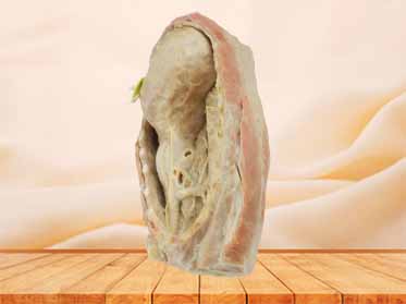 Mediastinum teaching specimen