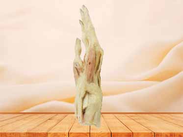 Middle muscles of hand plastinated specimen