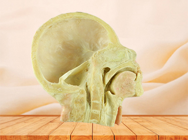 Muscles of nek and carotid plastinated specimen