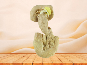 Pancreas duodenum and spleen for sale