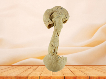 Pancreas duodenum and spleen medical specimen