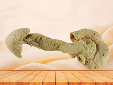 Pancreas duodenum and spleen plastinated specimen