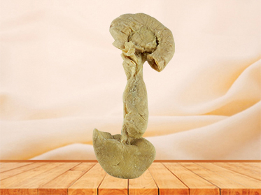 Pancreas duodenum and spleen specimen for sale