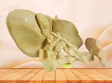 Pancreas spleen and duodenum for sale